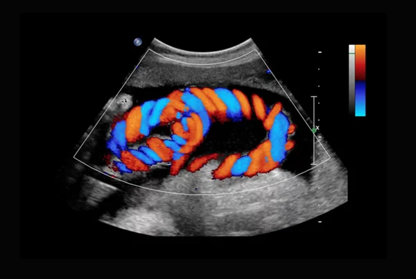 Obstetrics Colour Doppler